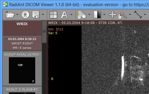 RadiAnt DICOM Viewer v2.2.3.10706