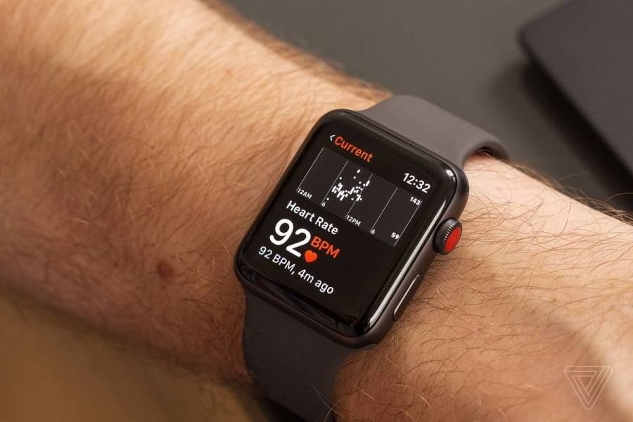 Yeni nəsil Apple Watch fiziki düymələrdən məhrum olacaq